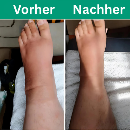 Viresta™ - 3 in 1 Beinmassagegerät