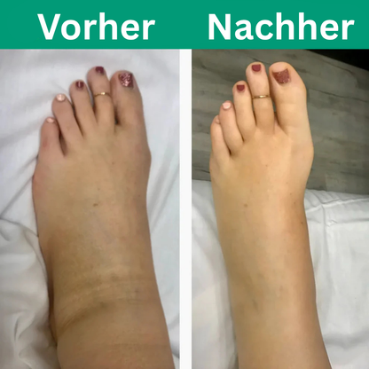 Viresta™ - 3 in 1 Beinmassagegerät