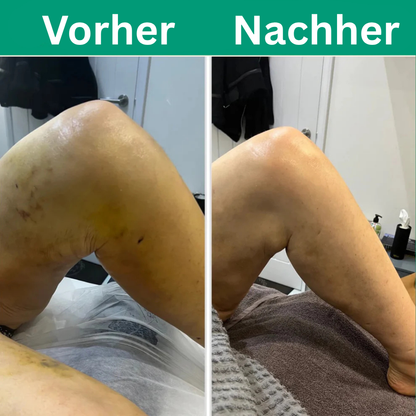 Viresta™ - 3 in 1 Beinmassagegerät